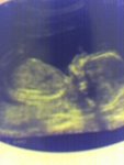 20wk scan.jpg