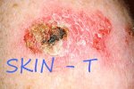 skin-t.jpg